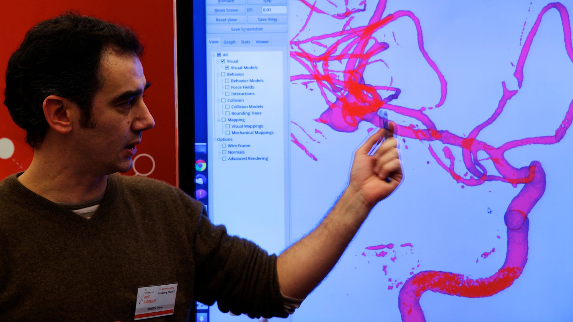 Simulation d'embolisation d'un anévrisme (2012)