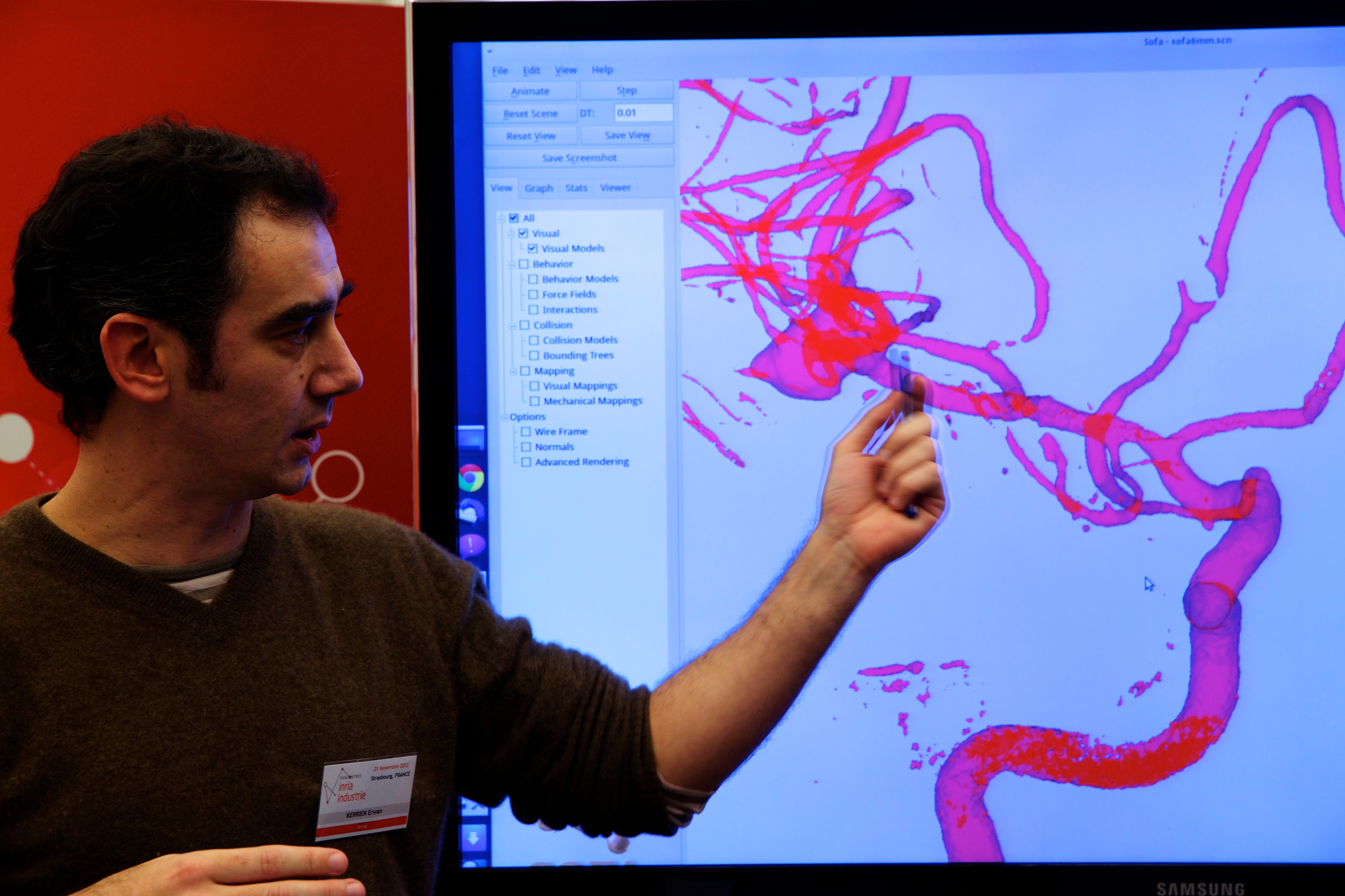 Simulation d'embolisation d'un anévrisme