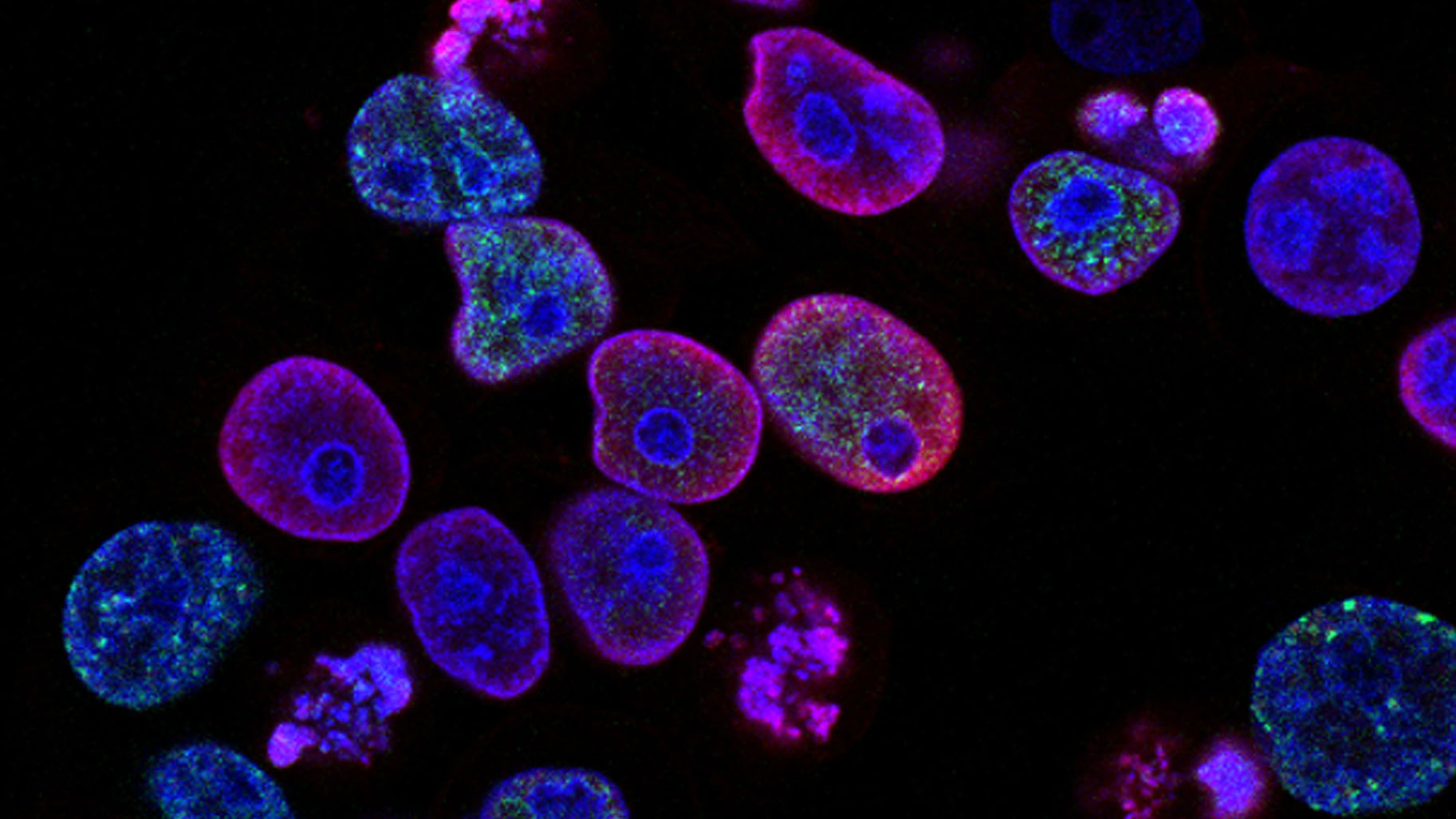 Traitement de cellules cancéreuses