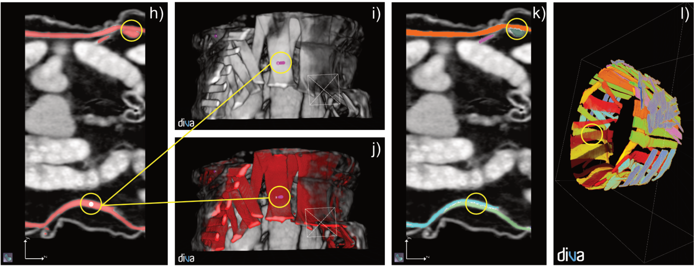 Cliché d'une procédure de segmentation des muscles d’une larve à partir d’un scanner.