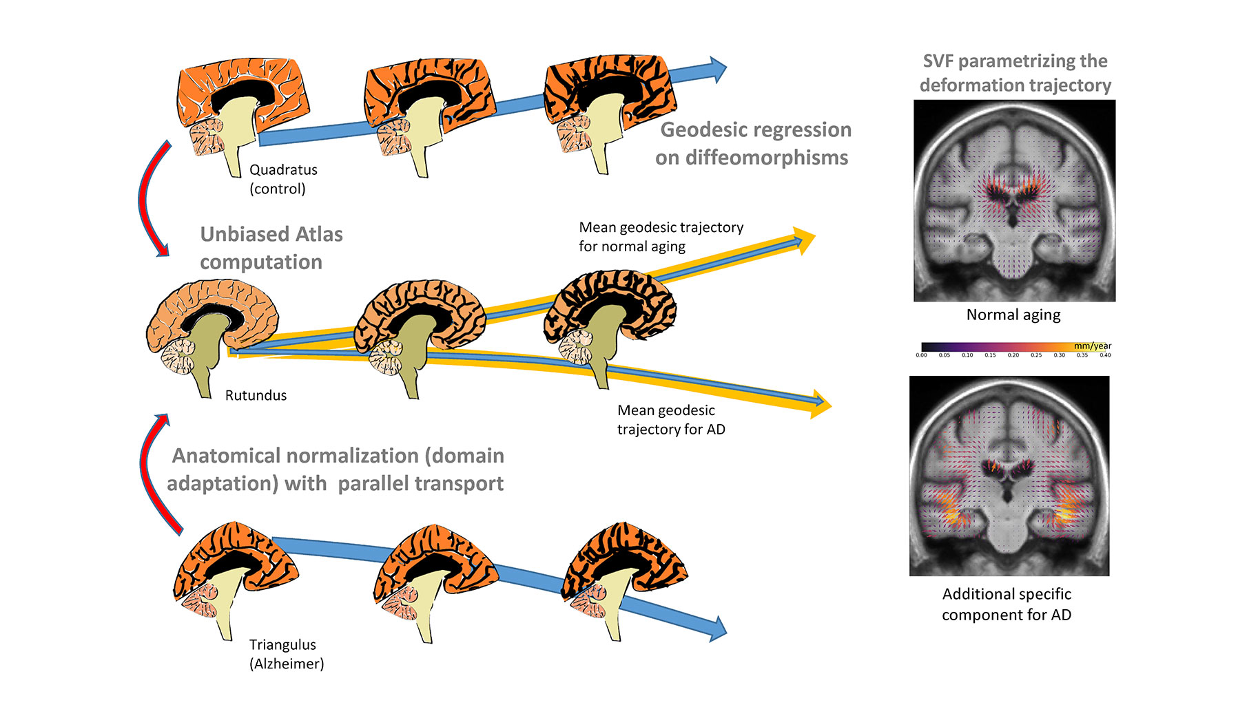 Modélisation de l'évolution de la forme du cerveau dans la maladie d'Alzheimer